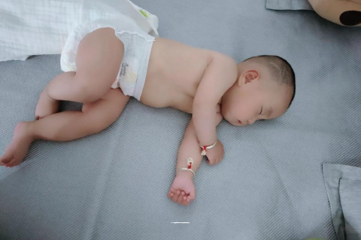 郯城六个月宝宝眼睛散光